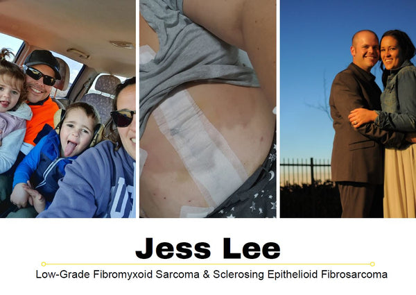 Sarcoma Survivor Stories: Meet Jess Lee